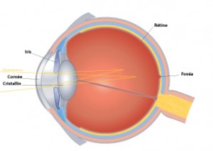 astigmatisme-oeil-astigmate